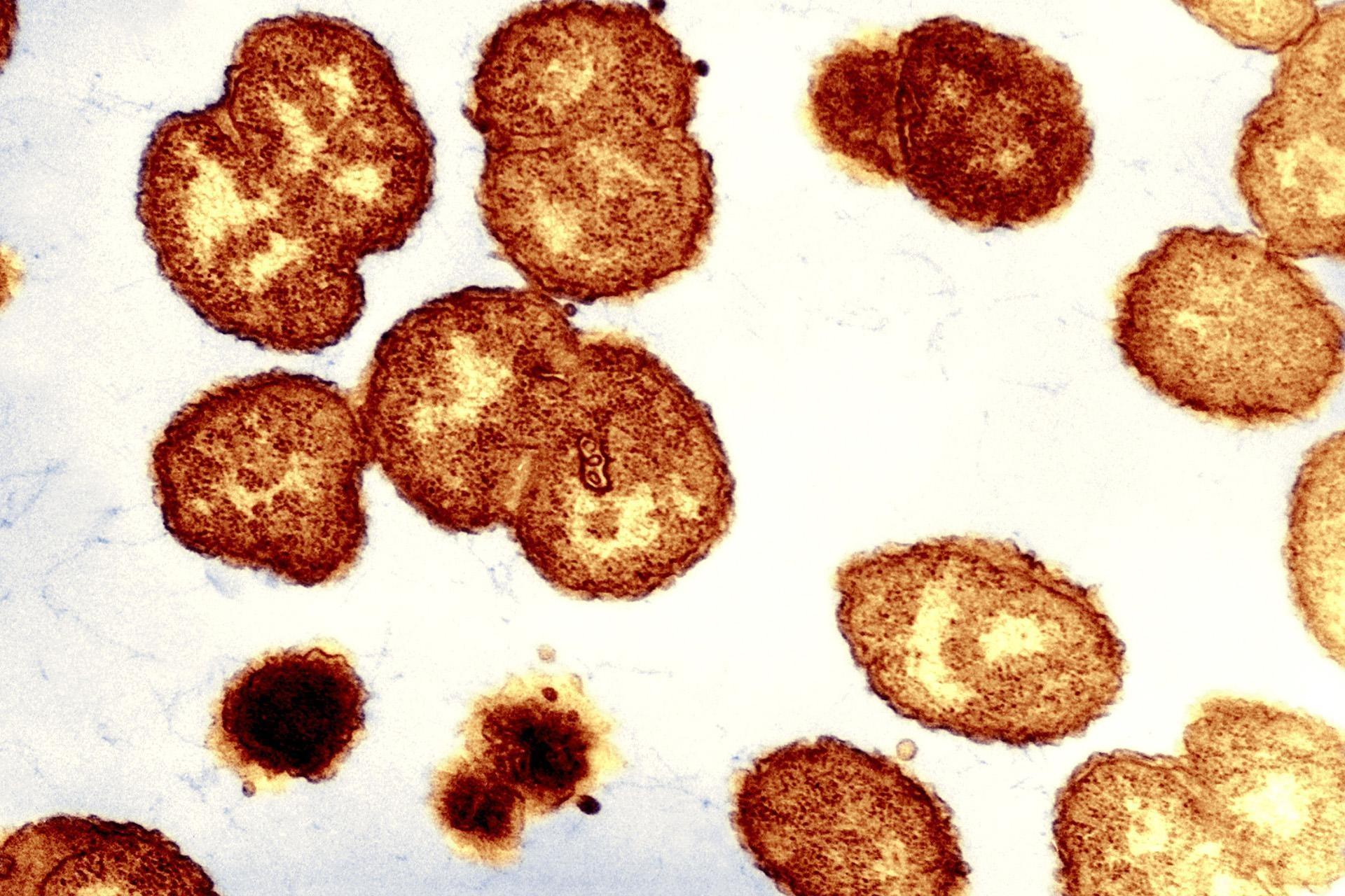 Chlamydia trachomatis neisseria gonorrhoeae. Гонорея возбудитель инфекции под микроскопом. Гонорея микрофотография.